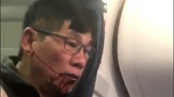 a man with blood on his face