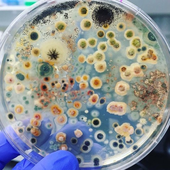 a hand holding a petri dish with different colored spots